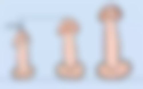 三、眼袋大怎么治疗比较好呢——其他辅助治疗方法