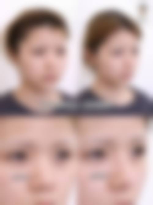 六、广州远东美容医院价格表