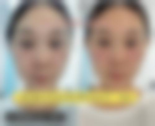 三、榆林专科医院整形美容科诊疗项目有哪些？