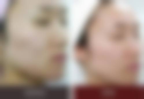 四、驻马店纽莱美医疗美容门诊部特色项目