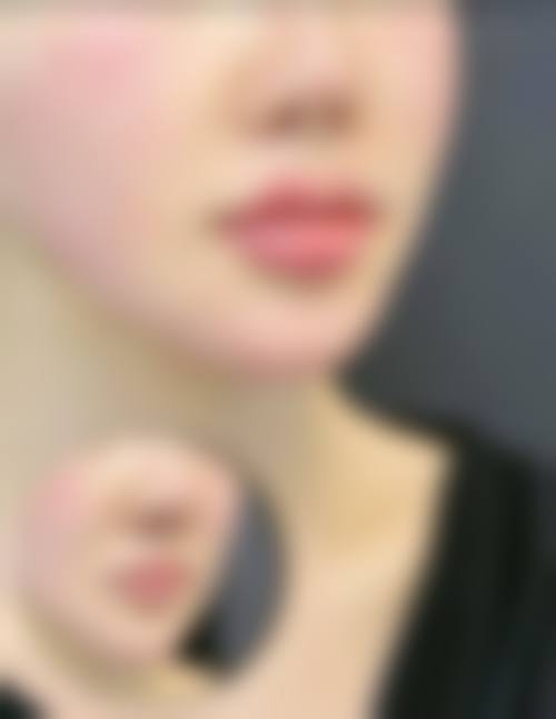 七、榆林专科医院整形美容科预约方式