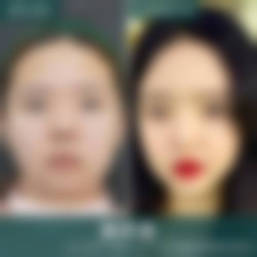 四、江西上饶韩美整形特色项目