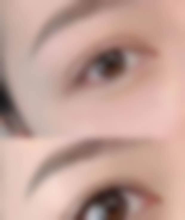 怎么样快速除眼袋和皱纹？多种方法大揭秘，还你紧致年轻双眸！ 