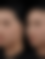 四、呼和浩特市赛罕区康医疗美容诊所特色项目