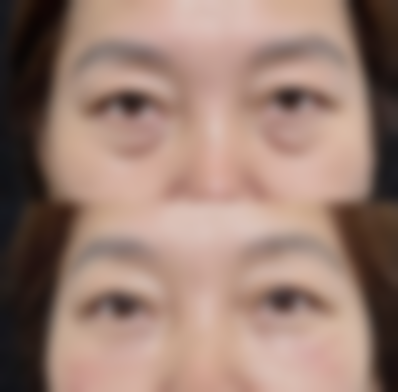 六、呼和浩特市赛罕区康医疗美容诊所价格表