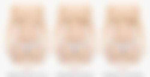 为什么打瘦脸针1个月没效果？原因大揭秘及科学应对方案来了！ 