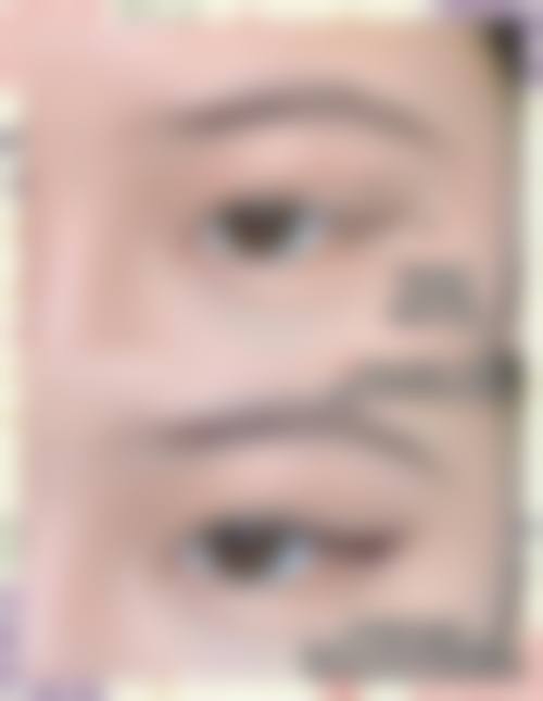 二、韩国朴宰佑整形外科怎么样？