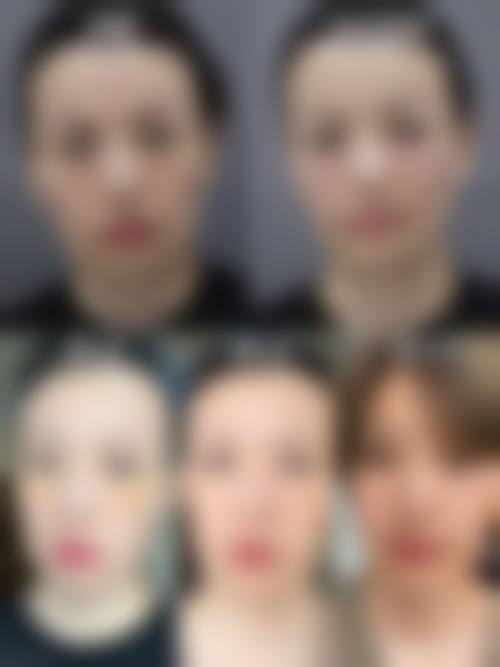 九、平顶山乐妍医疗美容门诊部真实的患者评价