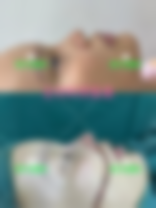 六、韩国朴宰佑整形外科价格表