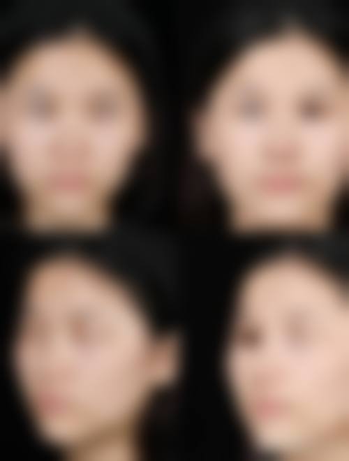 九、乌兰察布美尚美整形医院真实的患者评价