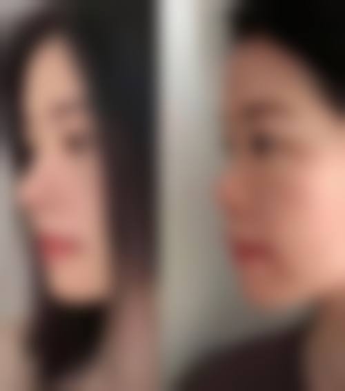 七、深圳珈溪（菲洛嘉）医疗美容诊所预约方式