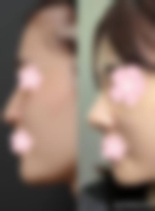 八、韩国朴宰佑整形外科预约方式