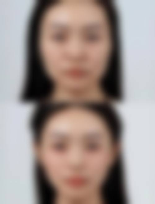 四、上海悦颜医疗美容门诊部特色项目