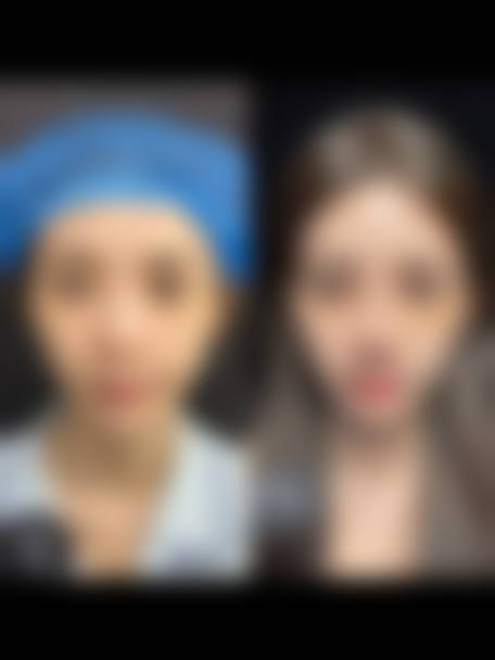 六、成都武侯颜美汇医学美容诊所价格表