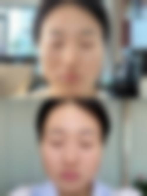 九、惠州韩美整形医疗美容门诊部真实的患者评价