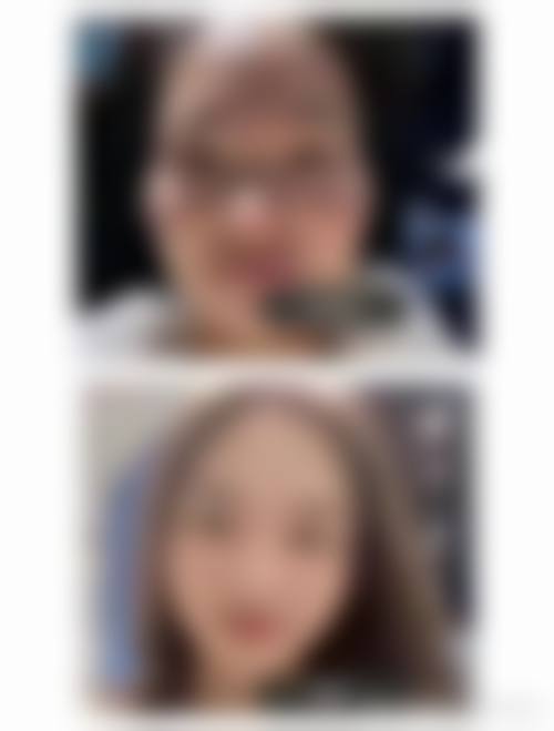 四、郑州欧华整形医院特色项目