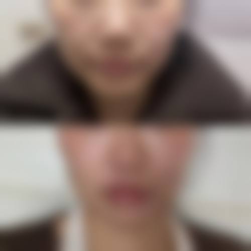 二、兰州市润妍医疗美容门诊部怎么样？