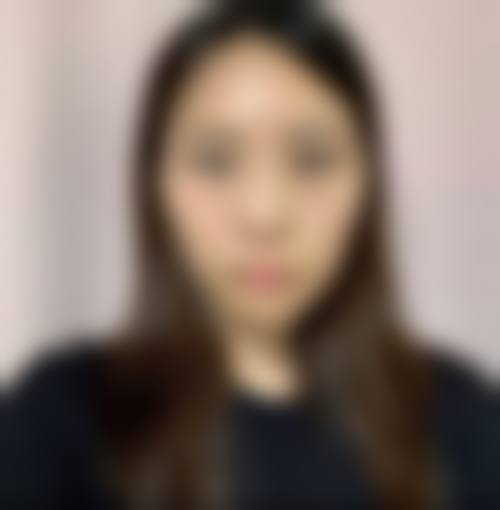 四、佛山加美整形医院特色项目