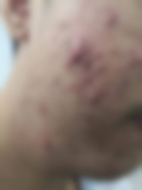 七、佳木斯科学大学附属第一医院皮肤科地址及交通