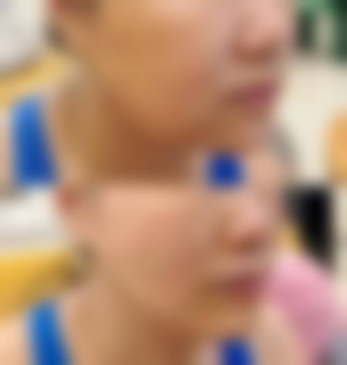 三、金华东阳市人民医院整形外科诊疗项目有哪些？