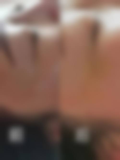 三、杭州碧莲盛无痕植发整形医院诊疗项目有哪些？