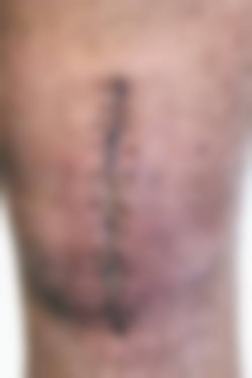 六、鲍金秀真实的患者评价