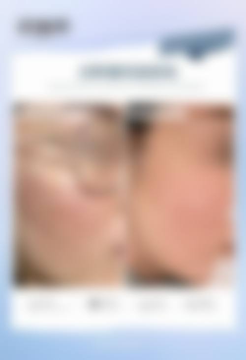 四、兰州市润妍医疗美容门诊部特色项目