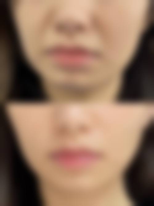 二、南宁美丽焦点医疗美容医院怎么样?