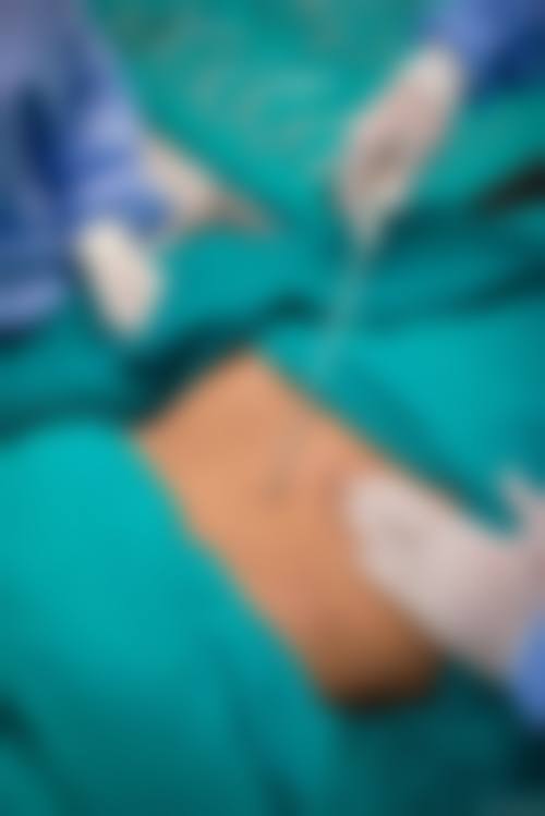 四、扬州慧纹医疗美容诊所特色项目