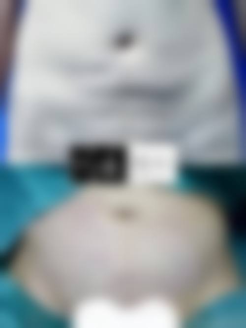 六、扬州慧纹医疗美容诊所价格表