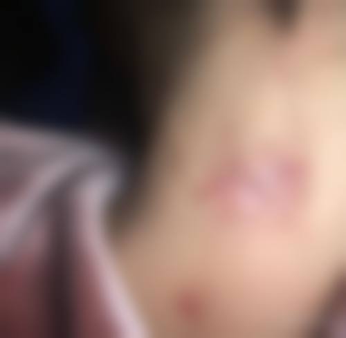 五、大眼睛整形外科价格表