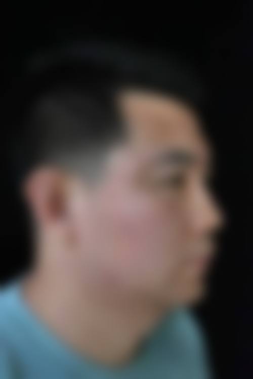 六、西湖碧莲盛医疗美容诊所价格表