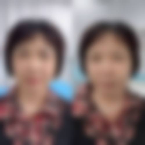 五、兰州市润妍医疗美容门诊部价格表