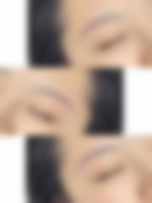 四、平顶山乐妍医疗美容门诊部特色项目