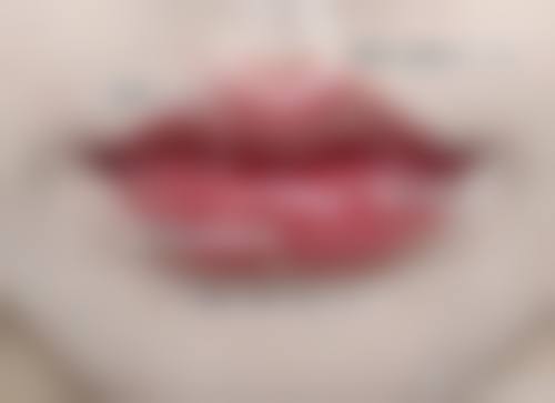 六、平顶山乐妍医疗美容门诊部价格表