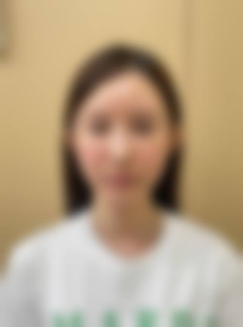 四、杭州碧莲盛无痕植发整形医院特色项目