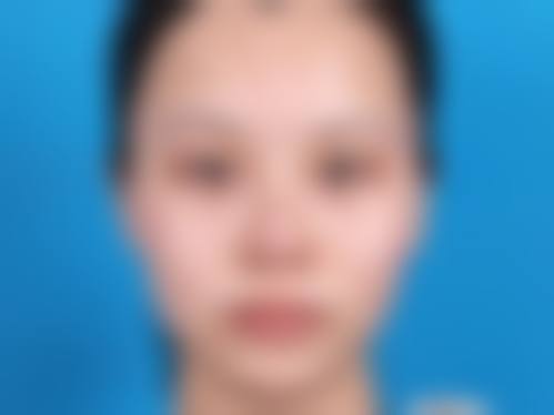 九、乌鲁木齐明医星医疗美容整形真实的患者评价