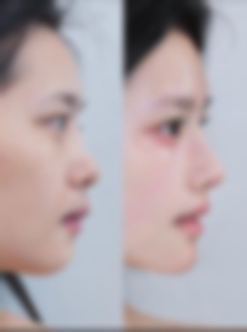 三、北京卉新秀颜诊所诊疗项目有哪些？