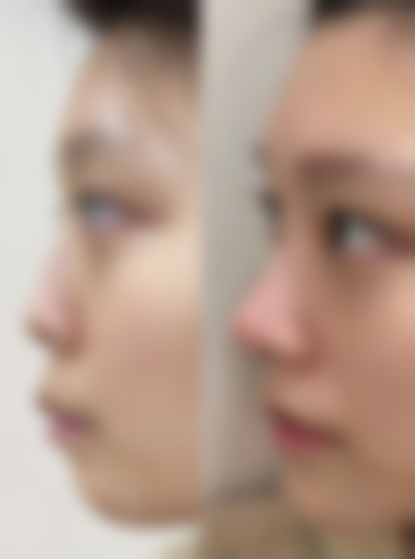 八、深圳珈溪（菲洛嘉）医疗美容诊所真实的患者评价