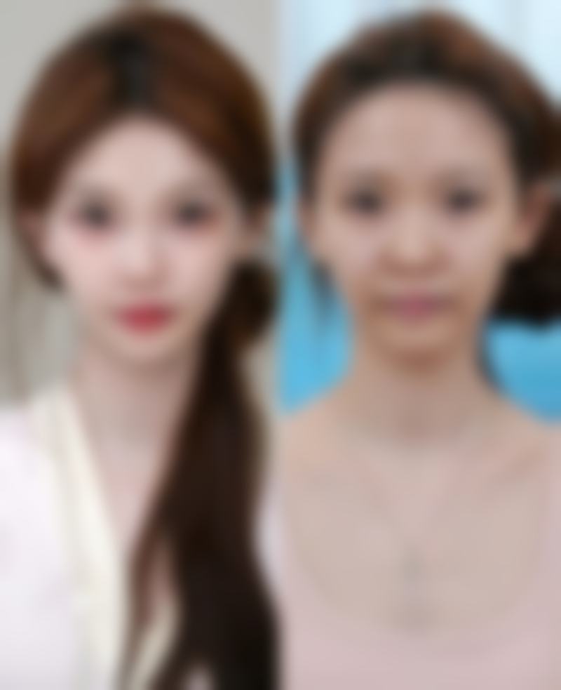 四、成都懿和丰德医学整形医院特色项目