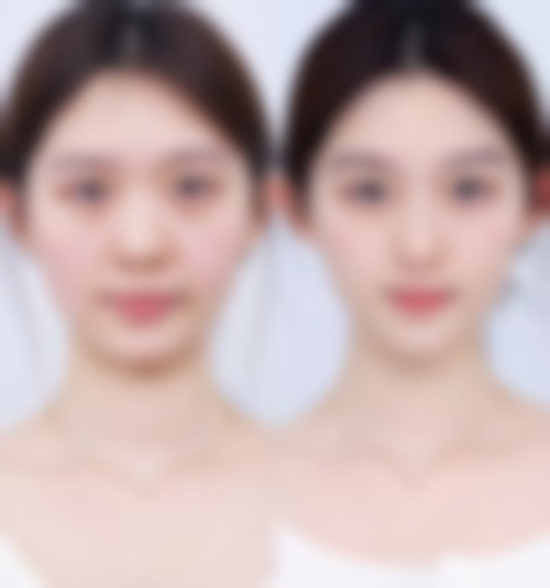 六、郑州欧华整形医院价格表