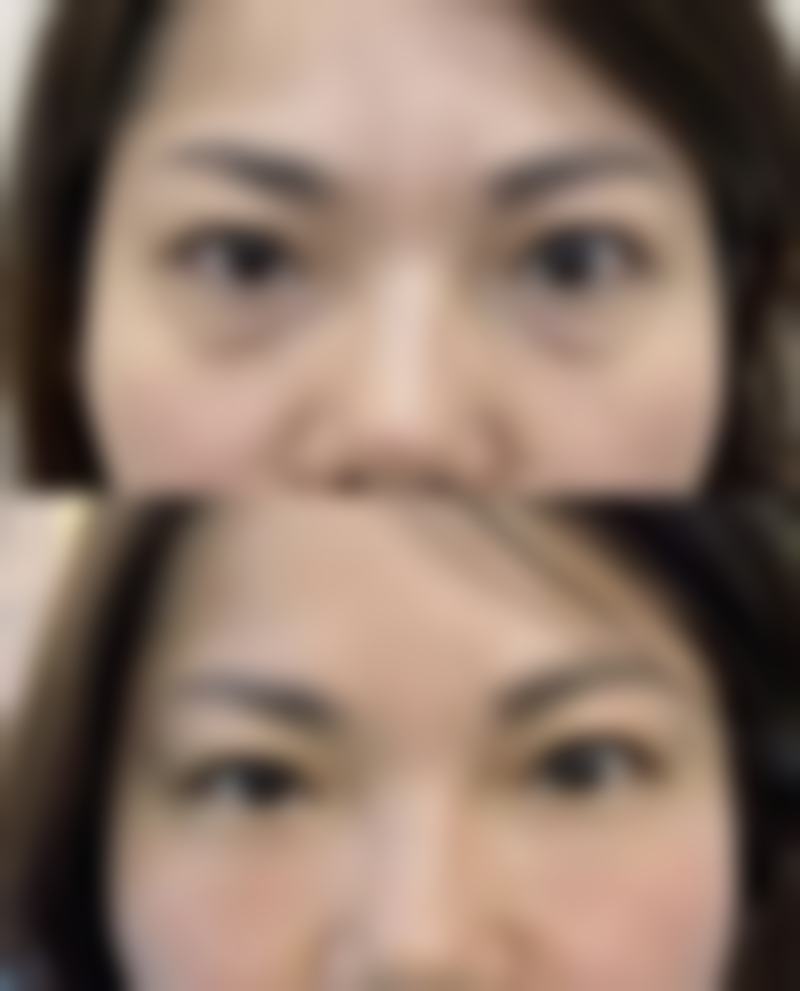 三、大眼睛整形外科诊疗项目有哪些？