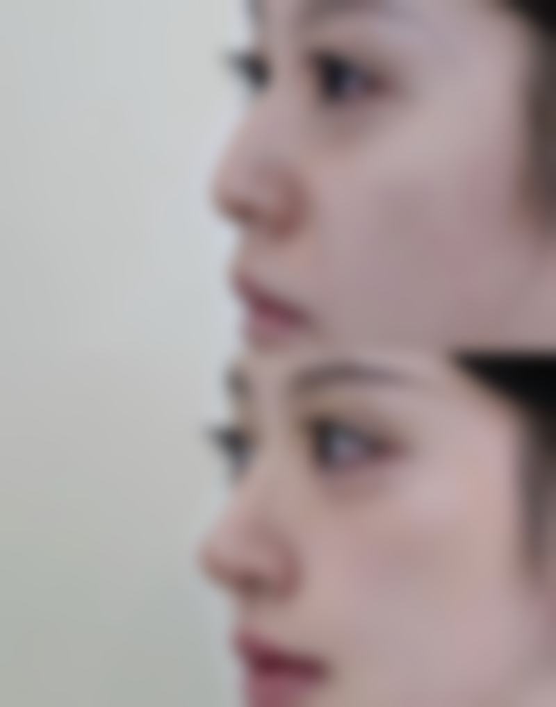 四、成都武侯颜美汇医学美容诊所特色项目