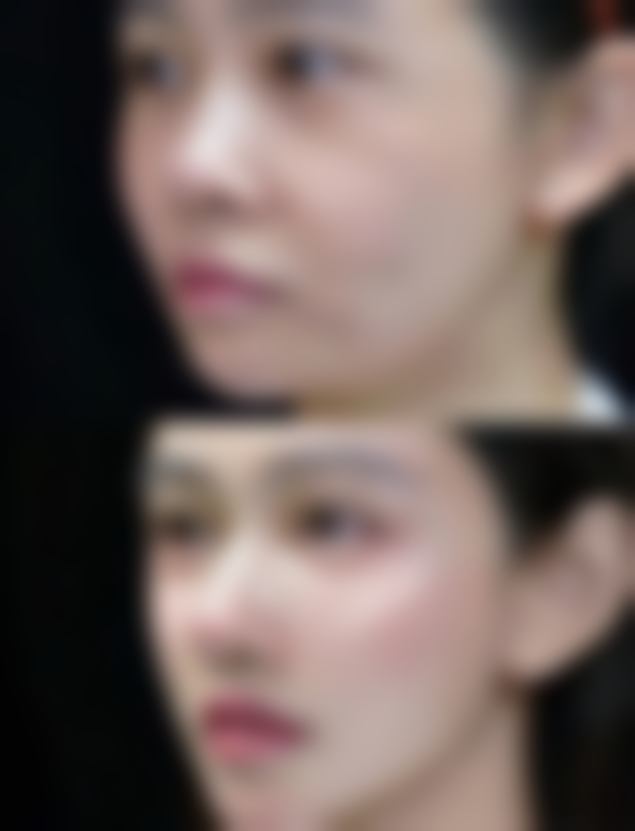 二、郑州欧华整形医院怎么样？