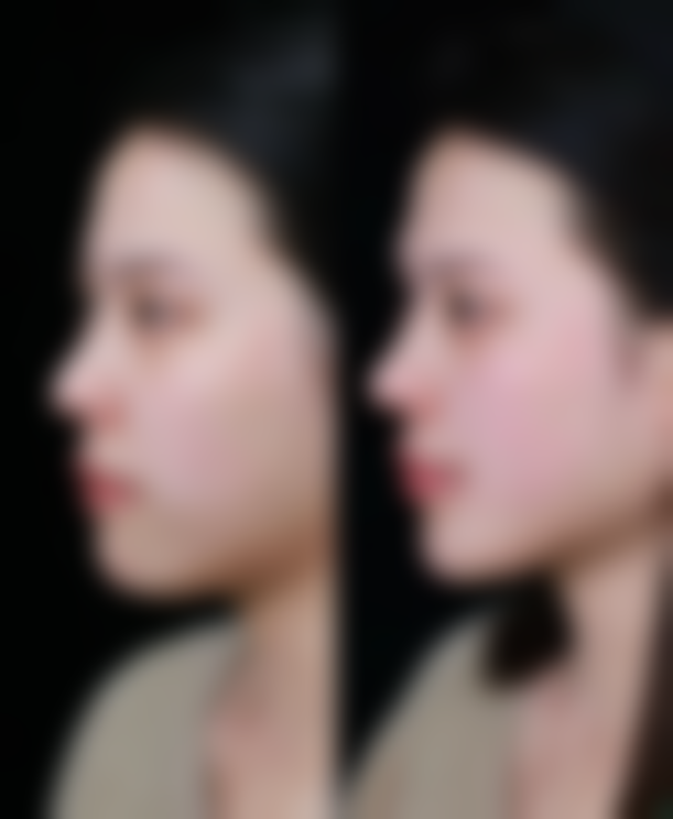 九、韩国朴宰佑整形外科真实的患者评价