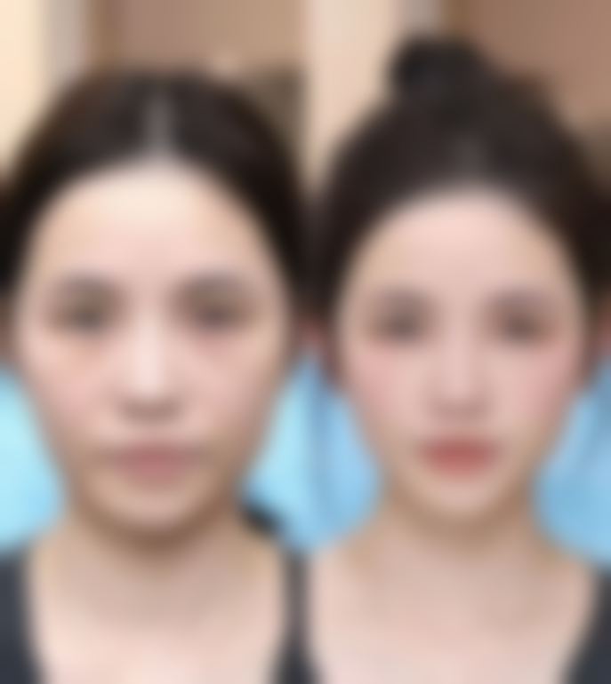 八、武汉米格医疗美容门诊部真实的患者评价