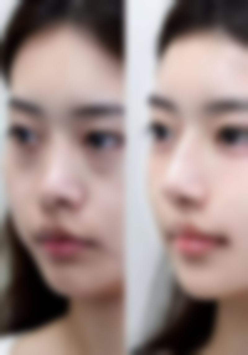 七、选择正规机构和医生的重要性