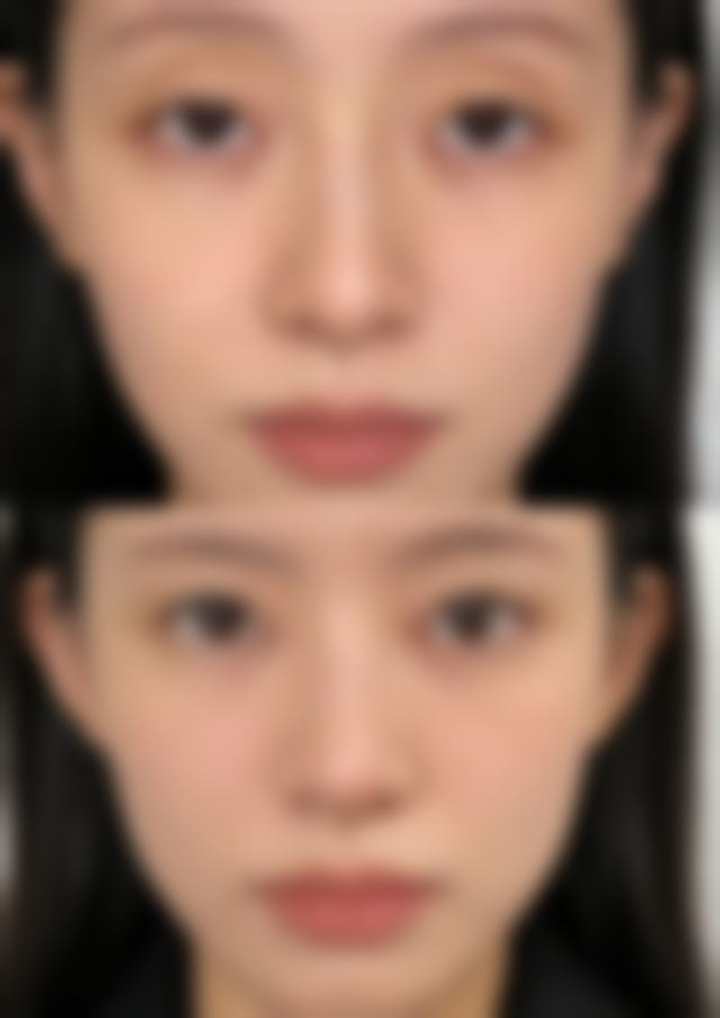 五、武汉米格医疗美容门诊部价格表