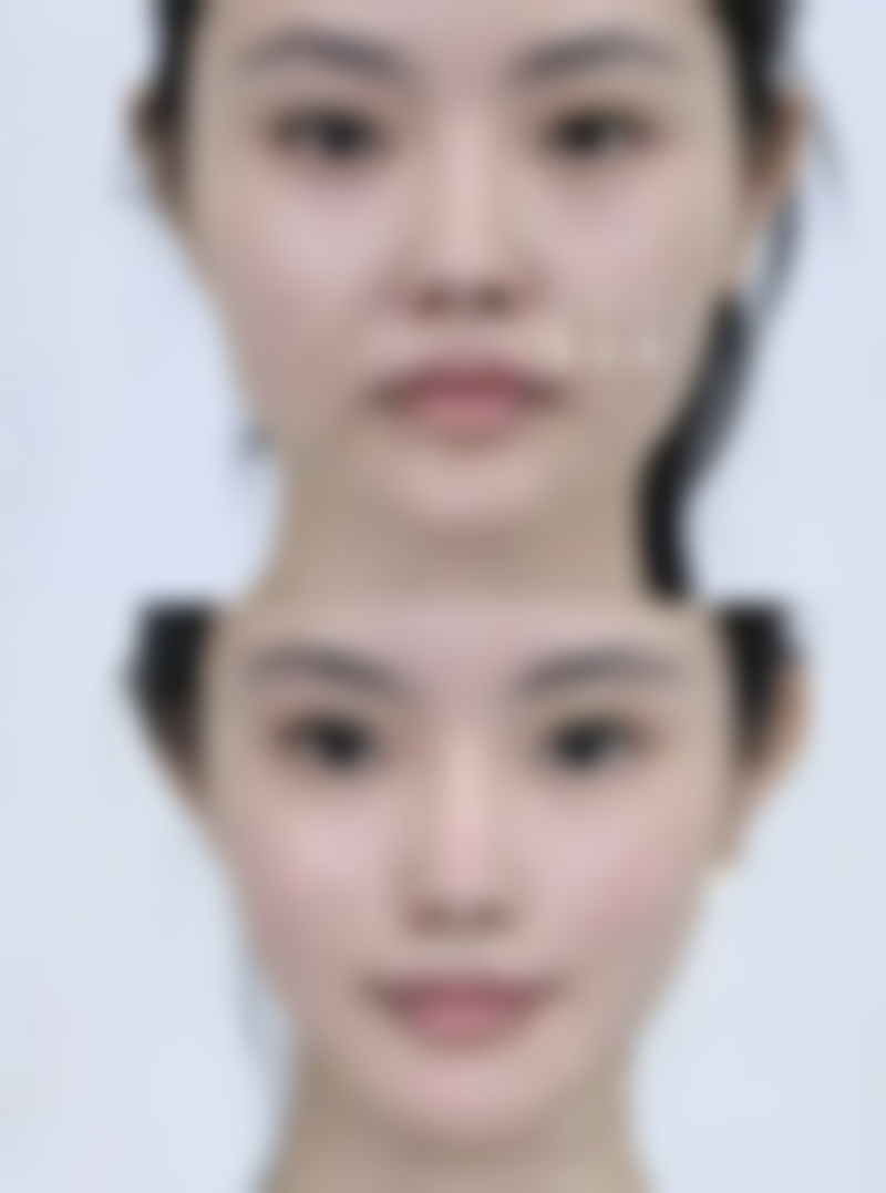 三、居家护理重点