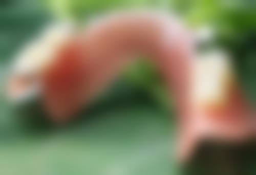 一、疤痕增生变黑的原因剖析